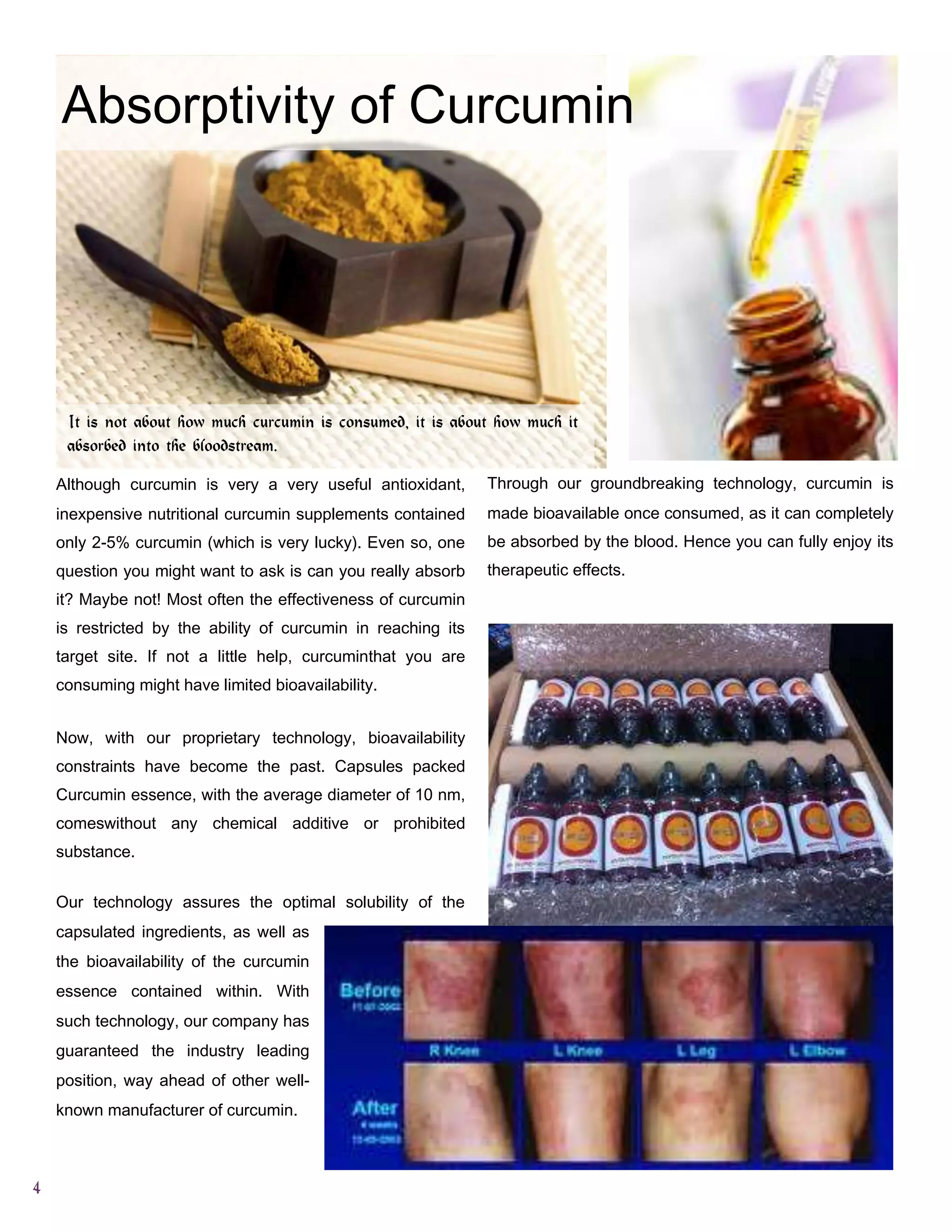 Absorptivity of Curcumin
Supplement

It is not about how much curcumin is consumed, it is about how much it
absorbed into the bloodstream.
Although curcumin is very a very useful antioxidant,

Through our groundbreaking technology, curcumin is

inexpensive nutritional curcumin supplements contained

made bioavailable once consumed, as it can completely

only 2-5% curcumin (which is very lucky). Even so, one

be absorbed by the blood. Hence you can fully enjoy its

question you might want to ask is can you really absorb

therapeutic effects.

it? Maybe not! Most often the effectiveness of curcumin
is restricted by the ability of curcumin in reaching its
target site. If not a little help, curcuminthat you are
consuming might have limited bioavailability.
Now, with our proprietary technology, bioavailability
constraints have become the past. Capsules packed
Curcumin essence, with the average diameter of 10 nm,
comeswithout any chemical additive or prohibited
substance.
Our technology assures the optimal solubility of the
capsulated ingredients, as well as
the bioavailability of the curcumin
essence contained within. With
such technology, our company has
guaranteed the industry leading
position, way ahead of other wellknown manufacturer of curcumin.

4

 