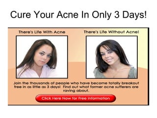 Cure Your Acne In Only 3 Days! 