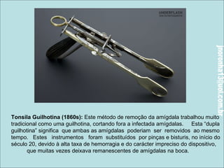 Instrumentos da Medicina Antiga