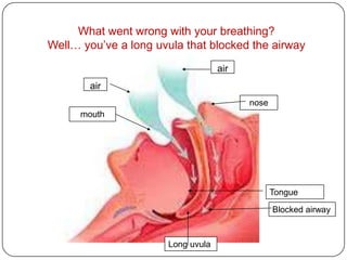 What went wrong with your breathing?
Well… you’ve a long uvula that blocked the airway
                                   air
        air
                                         nose
      mouth




                                                Tongue

                                                Blocked airway


                      Long uvula
 