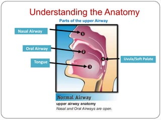 Understanding the Anatomy
                 Parts of the upper Airway

Nasal Airway


   Oral Airway

                                             Uvula/Soft Palate
       Tongue
 