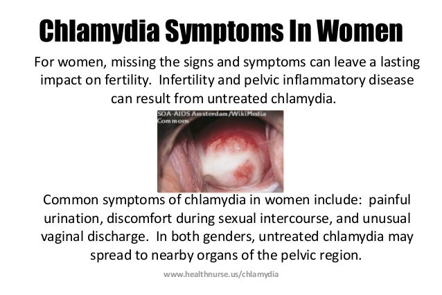 gonorrhea symptoms in the throat
