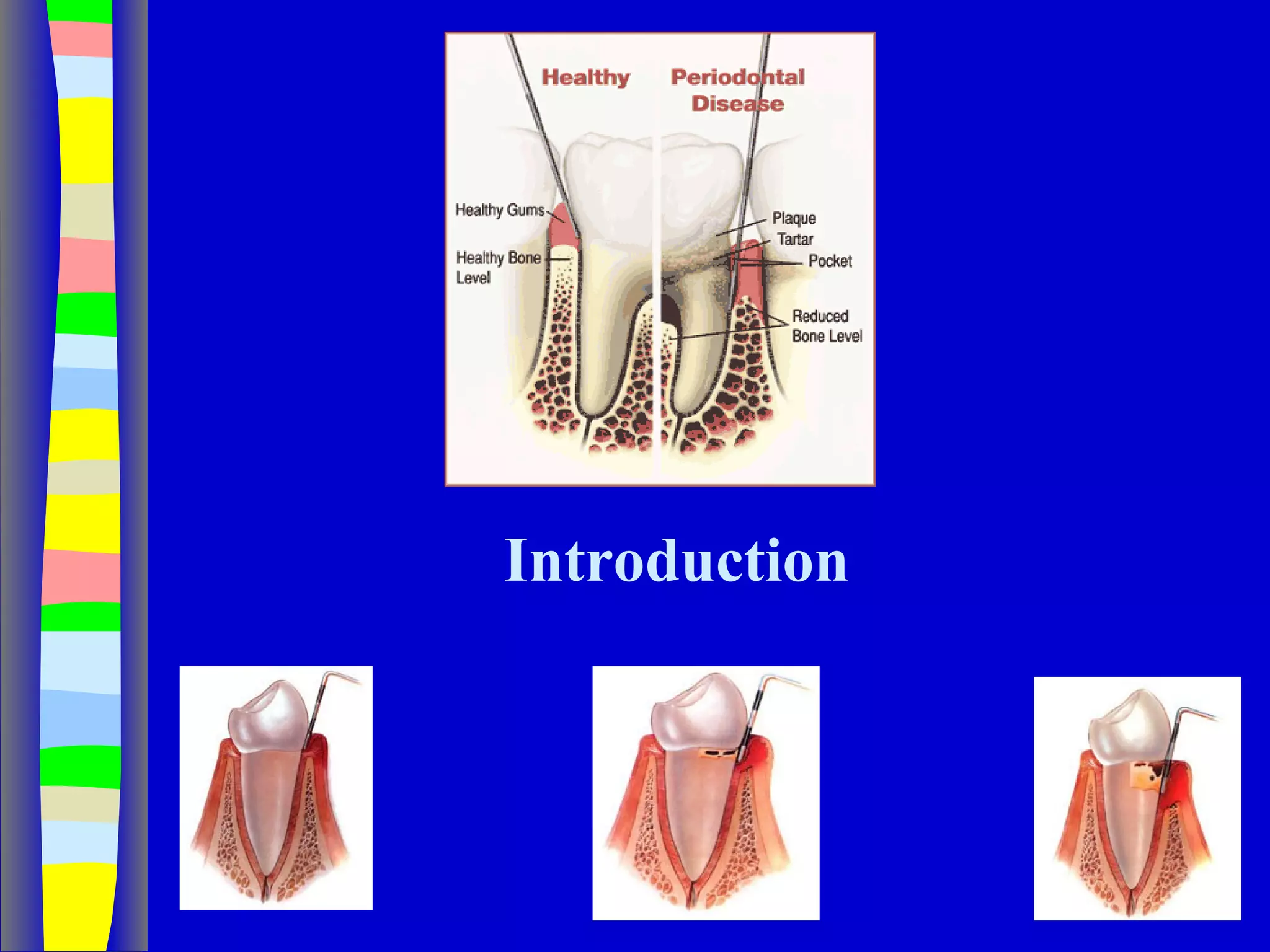 Curettage, gingivectomy & gingivoplasty PPT