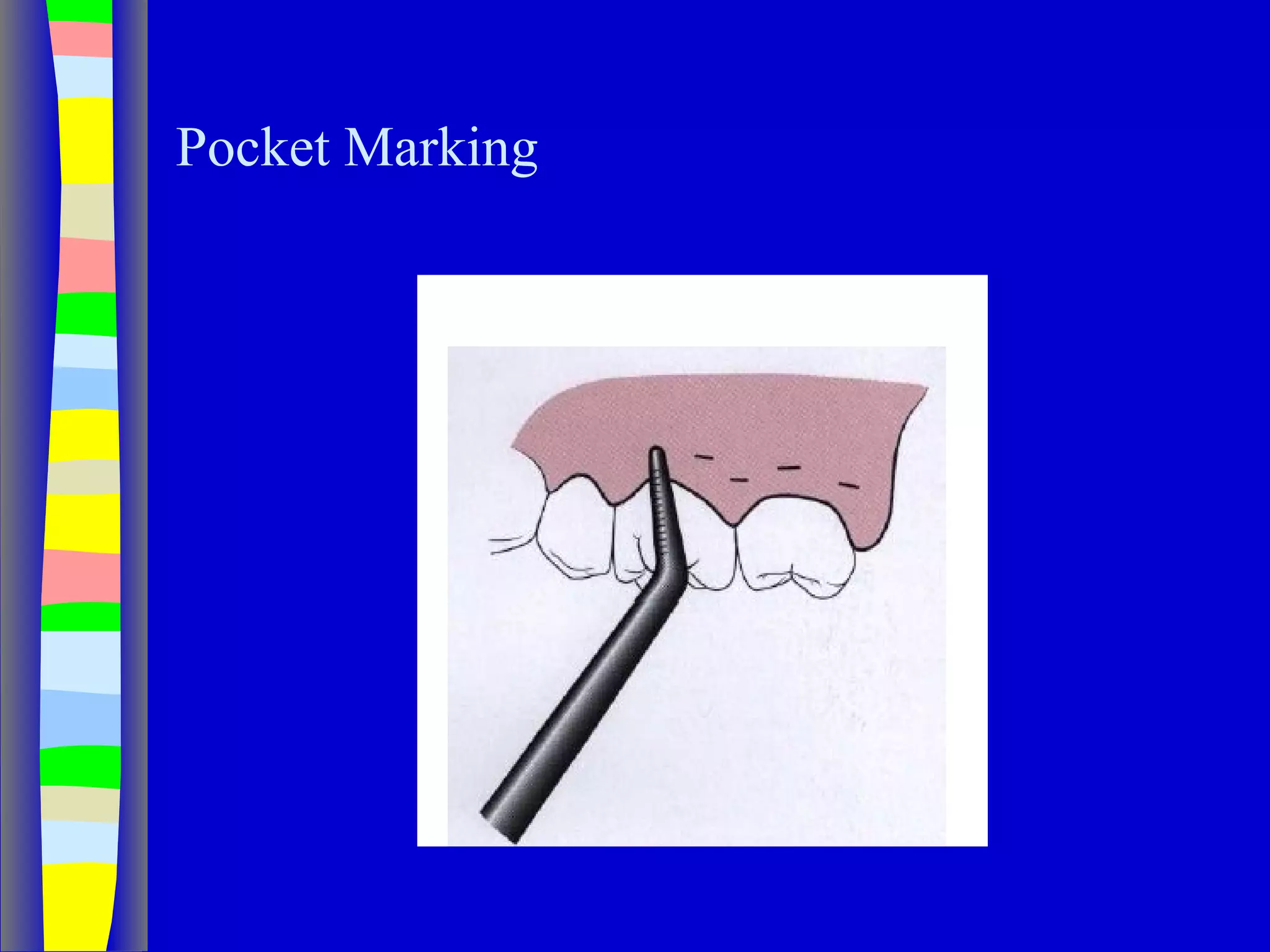 Curettage, gingivectomy & gingivoplasty PPT