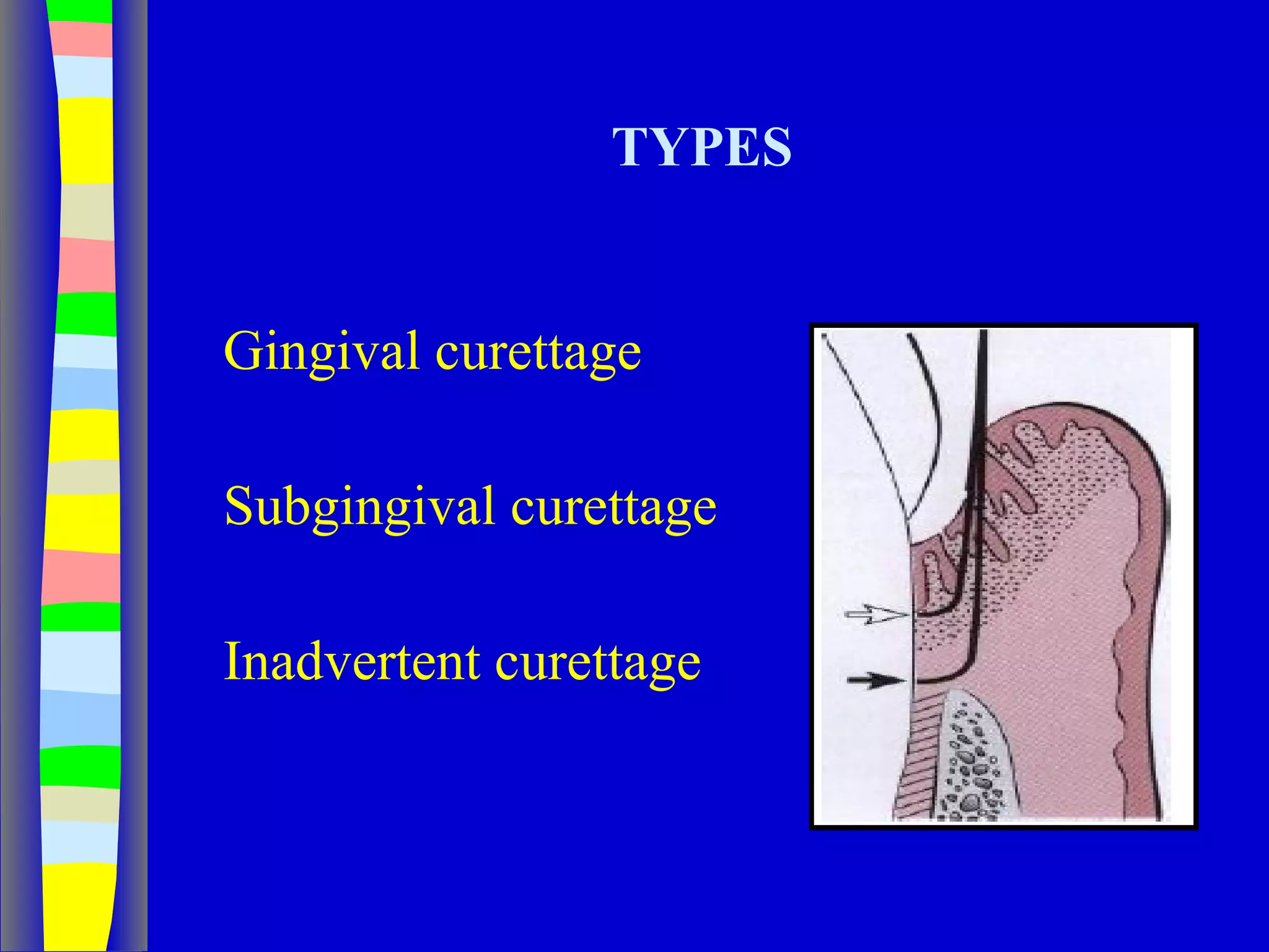 Curettage, gingivectomy & gingivoplasty PPT