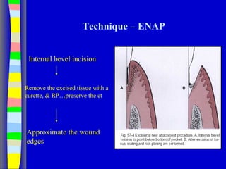Technique – ENAP
Internal bevel incision
Remove the excised tissue with a
curette, & RP…preserve the ct
Approximate the wound
edges
 
