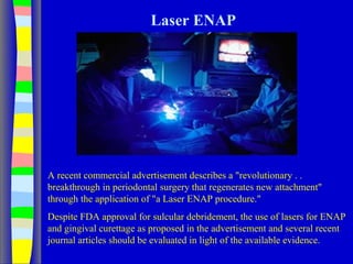 Laser ENAP
A recent commercial advertisement describes a "revolutionary . .
breakthrough in periodontal surgery that regenerates new attachment"
through the application of "a Laser ENAP procedure."
Despite FDA approval for sulcular debridement, the use of lasers for ENAP
and gingival curettage as proposed in the advertisement and several recent
journal articles should be evaluated in light of the available evidence.
 