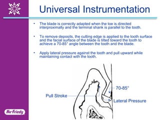 Curettes Clinical Application Guide | PPT