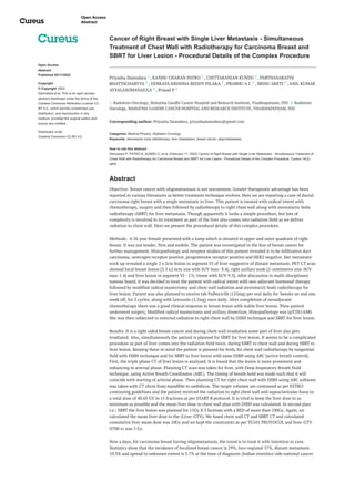 Open Access
Abstract
Published 02/11/2022
Copyright
© Copyright 2022
Damodara et al. This is an open access
abstract distributed under the terms of the
Creative Commons Attribution License CC-
BY 4.0., which permits unrestricted use,
distribution, and reproduction in any
medium, provided the original author and
source are credited.
Distributed under
Creative Commons CC-BY 4.0
Cancer of Right Breast with Single Liver Metastasis - Simultaneous
Treatment of Chest Wall with Radiotherapy for Carcinoma Breast and
SBRT for Liver Lesion - Procedural Details of the Complex Procedure
Priyasha Damodara , KANHU CHARAN PATRO , CHITTARANJAN KUNDU , PARTHASARATHI
BHATTACHARYYA , VENKATA KRISHNA REDDY PILAKA , PRABHU A C , SRINU AKETI , ANIL KUMAR
AYYALASOMAYAJULA , Prasad P
1. Radiation Oncology, Mahatma Gandhi Cancer Hospital and Research Institute, Visakhapatnam, IND 2. Radiation
Oncology, MAHATMA GANDHI CANCER HOSPITAL AND RESEARCH INSTITUTE, VISAKHAPATNAM, IND
Corresponding author: Priyasha Damodara, priyashadamodara@gmail.com
Categories: Medical Physics, Radiation Oncology
Keywords: stereotactic body radiotherapy, liver metastases, breast cancer, oligometastases
How to cite this abstract
Damodara P, PATRO K, KUNDU C, et al. (February 11, 2022) Cancer of Right Breast with Single Liver Metastasis - Simultaneous Treatment of
Chest Wall with Radiotherapy for Carcinoma Breast and SBRT for Liver Lesion - Procedural Details of the Complex Procedure. Cureus 14(2):
a692
Abstract
Objective: Breast cancer with oligometastasis is not uncommon. Greater therapeutic advantage has been
reported in various literatures as better treatment technique evolves. Here we are reporting a case of ductal
carcinoma right breast with a single metastasis to liver. This patient is treated with radical intent with
chemotherapy, surgery and then followed by radiotherapy to right chest wall along with stereotactic body
radiotherapy (SBRT) for liver metastasis. Though apparently it looks a simple procedure, but lots of
complexity is involved in its treatment as part of the liver also comes into radiation field as we deliver
radiation to chest wall. Here we present the procedural details of this complex procedure.
Methods: A 56 year female presented with a lump which is situated in upper and outer quadrant of right
breast. It was not tender, firm and mobile. The patient was investigated in the line of breast cancer for
further management. Histopathology and receptor studies of this patient revealed it to be infiltrative duct
carcinoma, oestrogen receptor positive, progesterone receptor positive and HER2 negative. Her metastatic
work up revealed a single 2 x 2cm lesion in segment VI of liver suggestive of distant metastasis. PET CT scan
showed local breast lesion [3.3 x2.6cm size with SUV max- 8.4], right axillary node [2-centimetre size-SUV
max-1.4] and liver lesion in segment VI - 17x 16mm with SUV-9.3]. After discussion in multi-disciplinary
tumour board, it was decided to treat the patient with radical intent with neo-adjuvant hormonal therapy
followed by modified radical mastectomy and chest wall radiation and stereotactic body radiotherapy for
liver lesion. Patient was also planned to receive tab Palbociclib (125mg) per oral daily for 3weeks on and one
week off, for 3 cycles; along with Letrozole (2.5mg) once daily. After completion of neoadjuvant
chemotherapy there was a good clinical response in breast lesion with stable liver lesion. Then patient
underwent surgery, Modified radical mastectomy and axillary dissection. Histopathology was ypT2N1AM0.
She was then subjected to external radiation to right chest wall by DIBH technique and SBRT for liver lesion.
Results: It is a right sided breast cancer and during chest wall irradiation some part of liver also gets
irradiated. Also, simultaneously the patient is planned for SBRT for liver lesion. It seems to be a complicated
procedure as part of liver comes into the radiation field twice, during EBRT to chest wall and during SBRT to
liver lesion. Keeping these in mind the patient is planned for both, for chest wall radiotherapy by tangential
field with DIBH technique and for SBRT to liver lesion with same DIBH using ABC [active breath control].
First, the triple phase CT of liver lesion is analysed. It is found that the lesion is more prominent and
enhancing in arterial phase. Planning CT scan was taken for liver, with Deep Inspiratory Breath Hold
technique, using Active Breath Coordinator (ABC). The timing of breath hold was made such that it will
coincide with starting of arterial phase. Then planning CT for right chest wall with DIBH using ABC software
was taken with CT slices from mandible to umbilicus. The target volumes are contoured as per ESTRO
contouring guidelines and the patient received the radiation to right chest wall and supraclavicular fossa to
a total dose of 40.05 GY in 15 fractions as per START B protocol. It is tried to keep the liver dose to as
minimum as possible and the mean liver dose in chest wall plan with DIBH was calculated. In second plan
i.e.; SBRT the liver lesion was planned for 15Gy X 3 factions with a BED of more than 100Gy. Again, we
calculated the mean liver dose to the (Liver-GTV). We fused chest wall CT and SBRT CT and calculated
cumulative liver mean dose was 10Gy and we kept the constraints as per TG101 PROTOCOL and liver-GTV
D700 cc was 3 Gy.
Now a days, for carcinoma breast having oligometastasis, the trend is to treat it with intention to cure.
Statistics show that the incidence of localized breast cancer is 29%, loco regional 57%, distant metastasis
10.3% and spread to unknown extent is 3.7% at the time of diagnosis (Indian statistics vide national cancer
1 2 2
2 2 2 2
2 2
Open Access
Abstract
 