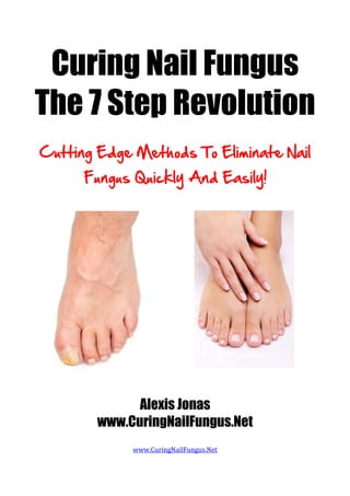 Curing Nail Fungus
The 7 Step Revolution
Cutting Edge Methods To Eliminate Nail
      Fungus Quickly And Easily!




              Alexis Jonas
        www.CuringNailFungus.Net
             www.CuringNailFungus.Net
 