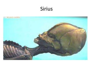Sirius
 