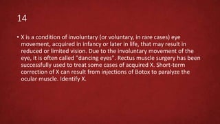 14
• X is a condition of involuntary (or voluntary, in rare cases) eye
movement, acquired in infancy or later in life, that may result in
reduced or limited vision. Due to the involuntary movement of the
eye, it is often called "dancing eyes". Rectus muscle surgery has been
successfully used to treat some cases of acquired X. Short-term
correction of X can result from injections of Botox to paralyze the
ocular muscle. Identify X.
 
