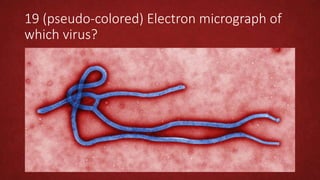 19 (pseudo-colored) Electron micrograph of
which virus?
 
