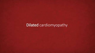 Dilated cardiomyopathy
 