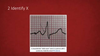 2 Identify X
 