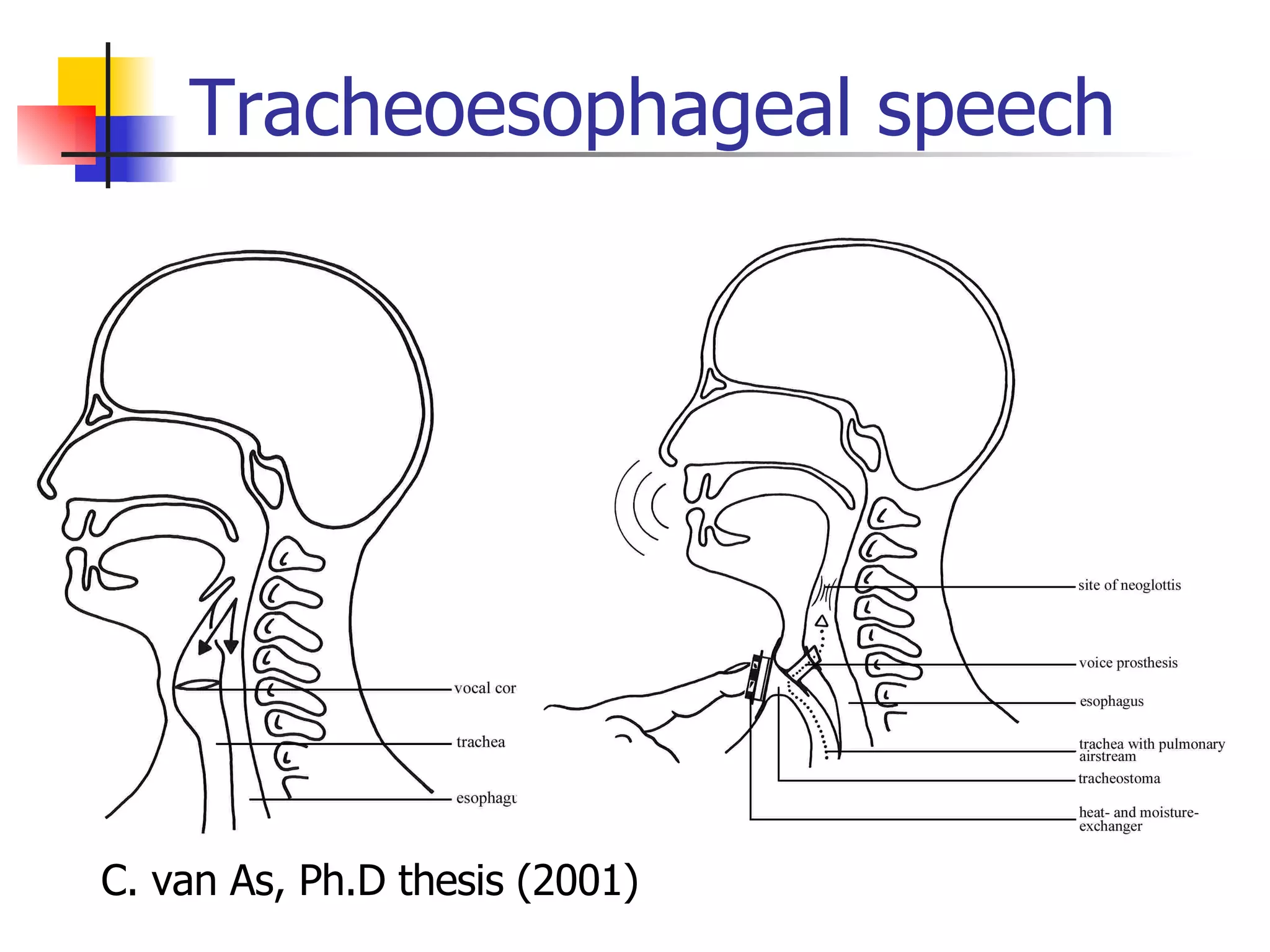 Tracheoesophageal speech C. van As, Ph.D thesis (2001) 
