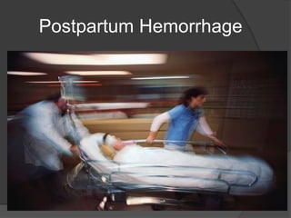 Postpartum Hemorrhage
 