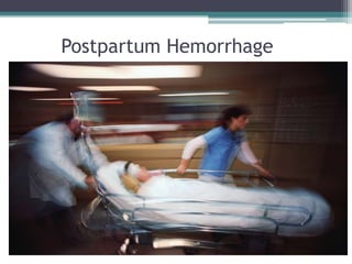 Postpartum Hemorrhage
 