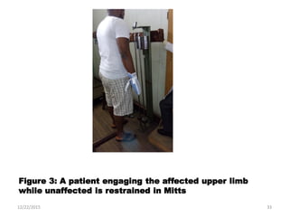 Current Techniques For Rehabilitation Of Upper Limb After Stroke | PDF