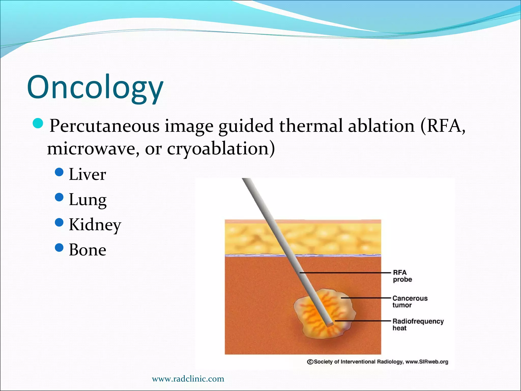 Thoracic Rfa Imaging Current applications of interventional radiology 97 | PPT