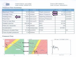 Unobstructed
Equivocal
Obstructed
 