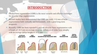CURRENT BONE SUBSTITUTES FOR IMPLANT DENTISTRY.pptx