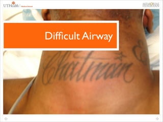 12

Difﬁcult Airway

 