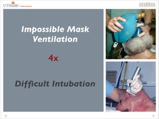 22

Impossible Mask
Ventilation

4x
Difﬁcult Intubation

 