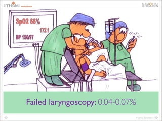 26

Failed laryngoscopy: 0.04-0.07%
Marco Brunori

 