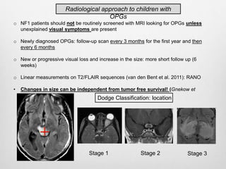 Current concepts in assessment of brain tumors - Dr Felice D'Arco | PPTX