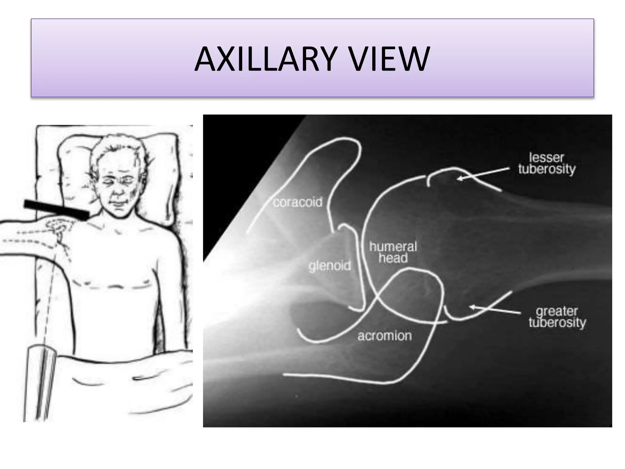 AXILLARY VIEW
 