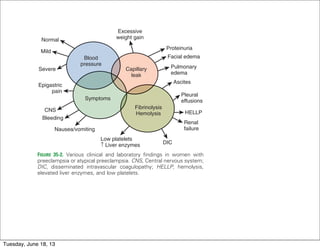 782 Section VI Pregnancy and Coexisting Disease
hypertension and approaches 50% wh
tension develops before 32 weeks’
these cases result in preterm deliver
Therefore, such women require close
detection of preeclampsia (frequen
serial evaluation of platelets and live
growth (serial ultrasound).
Preeclampsia should also be con
tional hypertension is severe becau
preterm delivery.11,20
Preeclampsia is clearly a heteroge-
neous condition for which the pathogenesis could be
different in women with various risk factors.11,20,21
The
pathogenesis of preeclampsia in nulliparous women may
be different than that in women with preexisting vascular
disease, multifetal gestation, diabetes mellitus, or previous
FIGURE 35-2. Various clinical and laboratory ﬁndings in women with
preeclampsia or atypical preeclampsia. CNS, Central nervous system;
DIC, disseminated intravascular coagulopathy; HELLP, hemolysis,
elevated liver enzymes, and low platelets.
Excessive
weight gain
Capillary
leak
Blood
pressure
Symptoms
Fibrinolysis
Hemolysis
DIC
Low platelets
↑ Liver enzymes
Nausea/vomiting
Bleeding
CNS
Epigastric
pain
Severe
Mild
Normal
Proteinuria
Facial edema
Pulmonary
edema
Ascites
Pleural
effusions
HELLP
Renal
failure
• Gestational hypertension plus o
following:
• Symptoms of preeclampsia
• Hemolysis
• Thrombocytopenia (<100,000/mm
• Elevated liver enzymes: two tim
the normal value for aspartate
and alanine transaminase (ALT)
• Gestational proteinuria plus on
following:
• Symptoms of preeclampsia
• Hemolysis
• Thrombocytopenia
• Elevated liver enzymes
• Early signs and symptoms of pree
at <20 weeks
• Late postpartum preeclampsia-ec
postpartum)
CRITERIA FOR ATYPICAL PR
Tuesday, June 18, 13
 