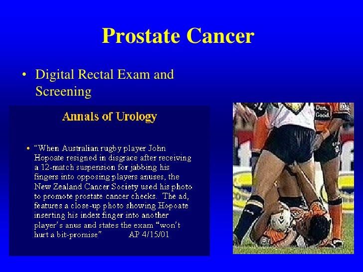 Image result for john hopoate prostate