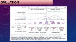 Current Management of Anovulatory Infertility | PPTX
