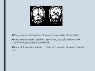 ■People with schizophrenia  enlarged ventricles of the brain;
■Posttraumatic stress disorder, depression, and schizophrenia 
size of the hippocampus is reduced
■Some children with autism  brain size expands at a much greater
rate
 