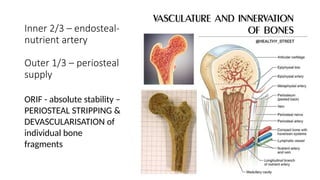 Devascularization Current Trends and Recent Advancements in Minimally Invasive Plate ...