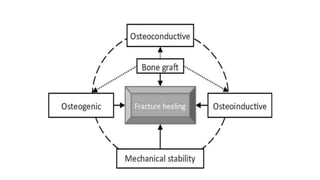 Current trends in treatment of fracture.pptx