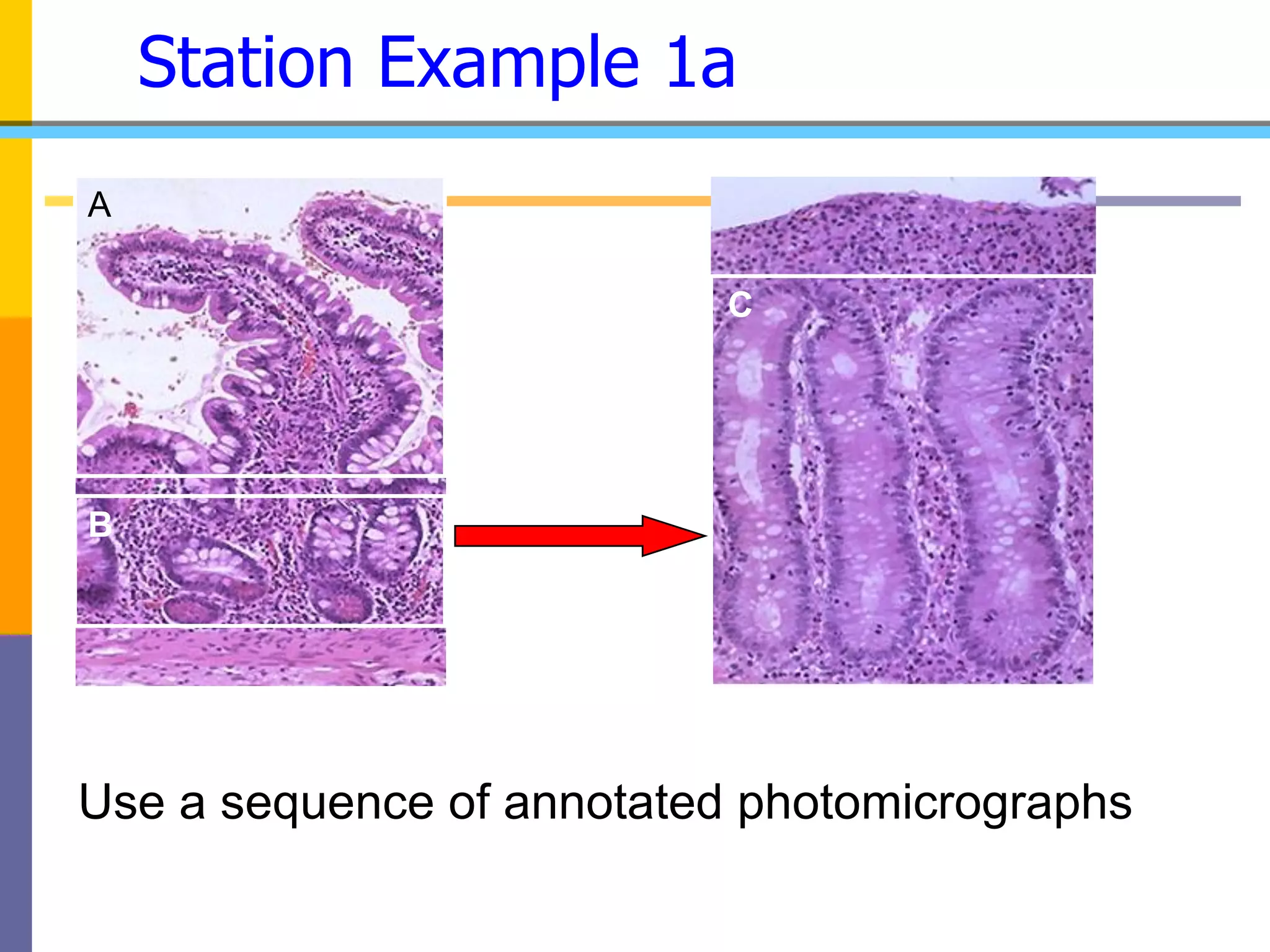 Station Example 1a
A
C
B
Use a sequence of annotated photomicrographs
 