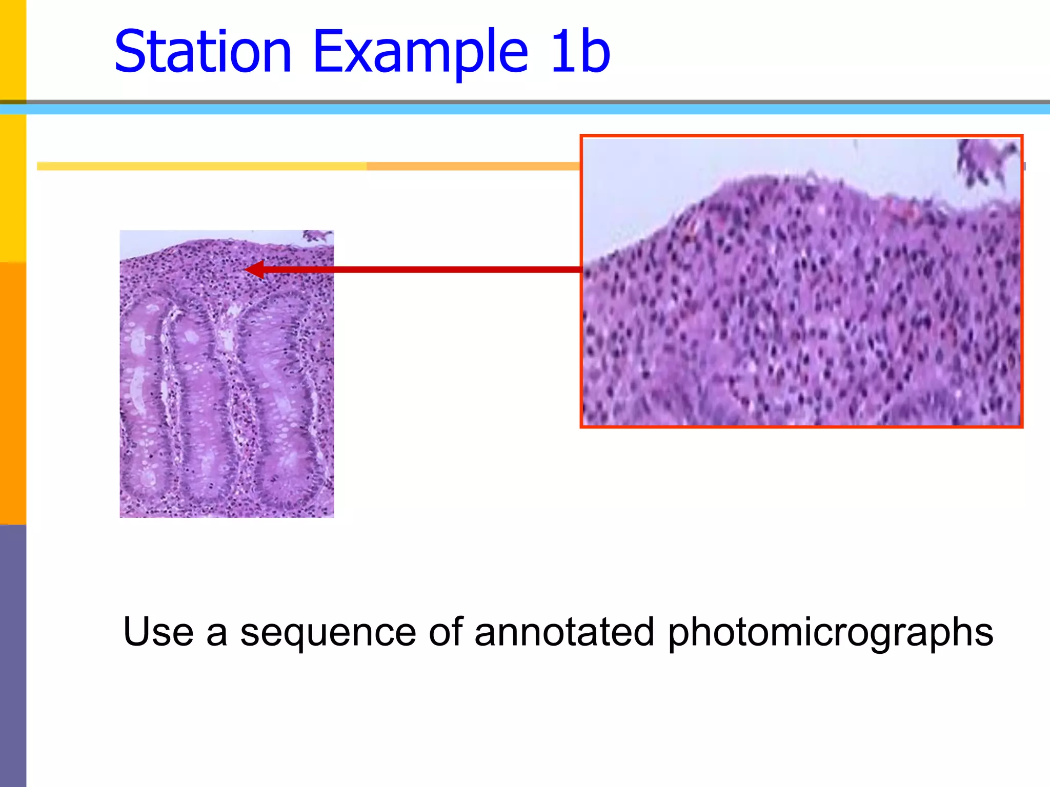 Click to enlarge area
Station Example 1b
Use a sequence of annotated photomicrographs
 