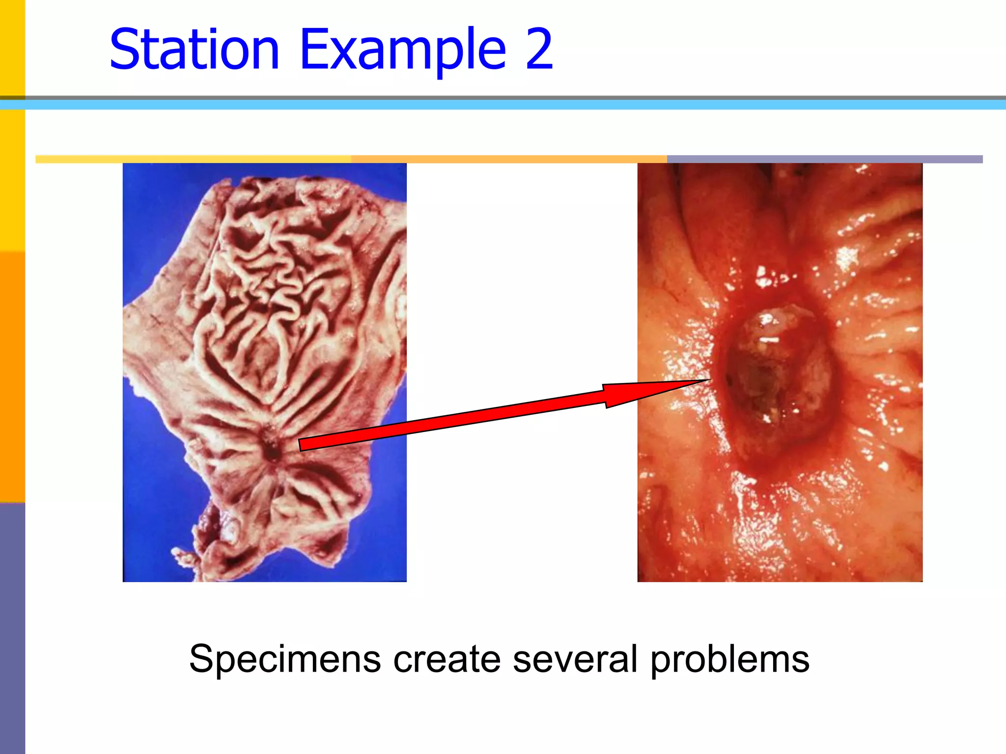 Station Example 2
Specimens create several problems
 