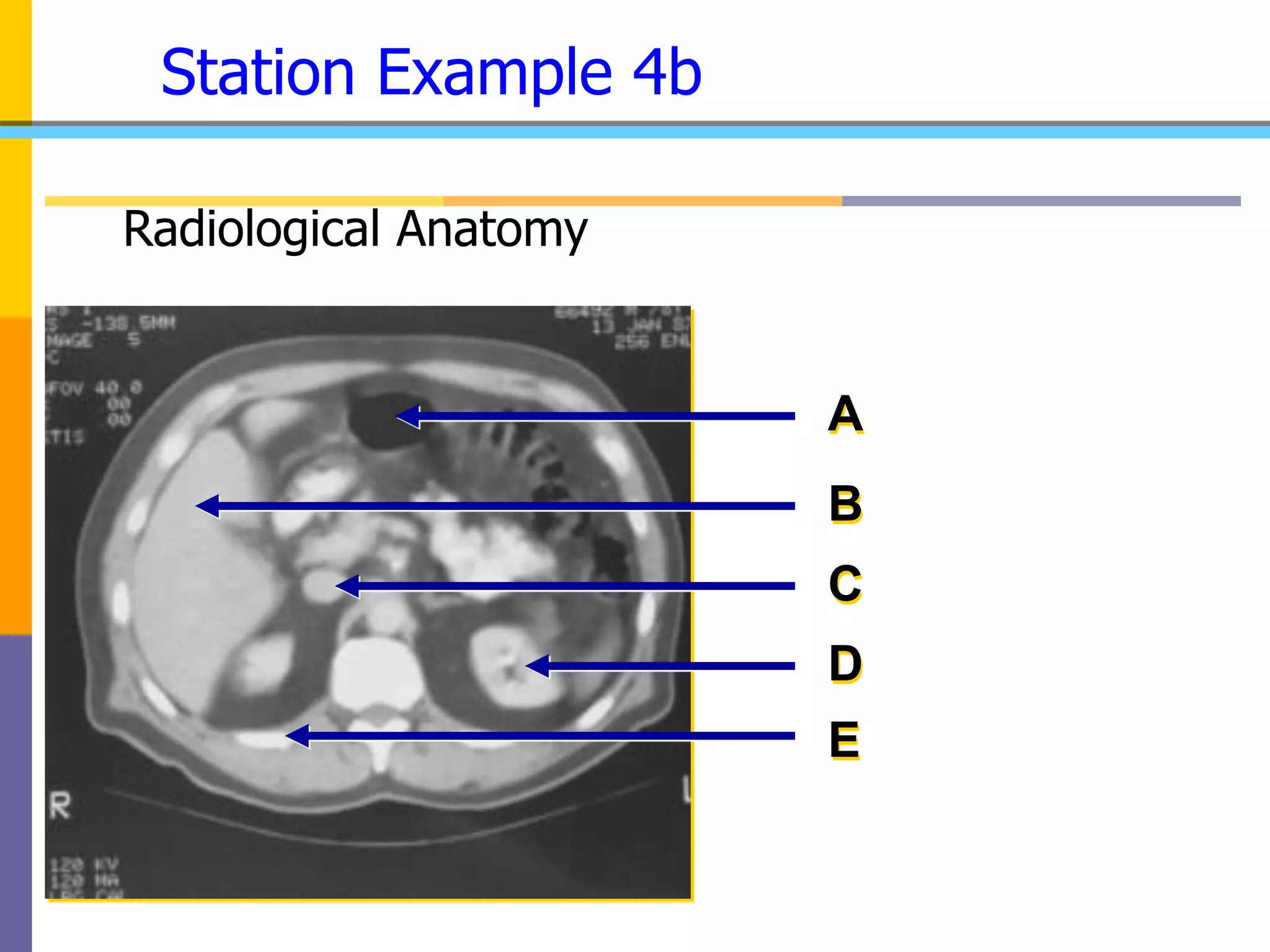 Station Example 4b
Radiological Anatomy
A
B
C
D
E
 