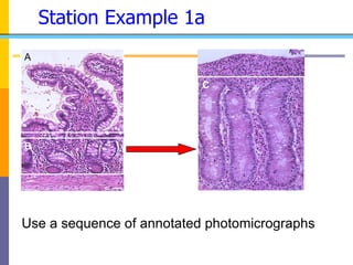 Station Example 1a
A
C
B
Use a sequence of annotated photomicrographs
 