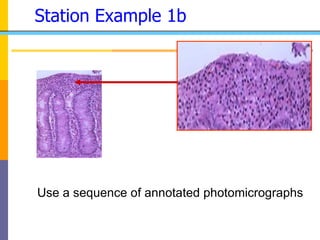Click to enlarge area
Station Example 1b
Use a sequence of annotated photomicrographs
 