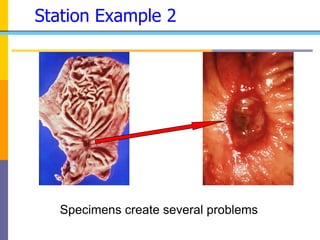 Station Example 2
Specimens create several problems
 