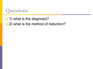 Questions
 1) what is the diagnosis?
 2) what is the method of reduction?
 