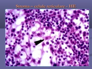 Curs 10-histo-organe-limfoide-periferice | PPT