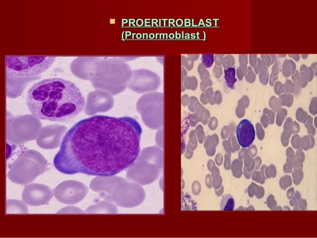 Biscuit TrezeÈ™tete MorgÄƒ Monocit Si Limfocit La Microscop Doctoragin Com