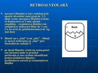 RETROALVEOLARĂ

   aşezarea filmului se face endobucal în
    spatele alveolelor unui grup de 2-3
    dinţi vecini, marginea filmului trebuie
    să depăşească cu 2 mm. planul
    cuspidian – examinarea dinţilor este
    completă;se utilizează filme de ¾ cm.      o   Back
    Cu un strat de gelatinobromură de Ag.
    mai dens
                                                    U
   filmele au o „faţă” si un „dos” – filmul
    se aşează totdeauna cu „faţa” spre
    fasciculul de radiaţii X

   pe dosul filmelor există un semn,punct
    sau incizură unde se practică
    perforaţia şi care trebuie identificată
    pentru prinderea filmelor,
    poziţionarea corectă şi recunoaşterea
    dinţilor
 