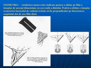 IZOMETRIA - totalitatea manevrelor indicate pentru a obţine pe film o
imagine de aceeaşi dimensiune cu cea reală a dintelui. Pentru a obţine o imagine
izometrică fasciculul de radiaţii trebuie să fie perpendicular pe bisectoarea
unghiului dat de axa film-dinte
 