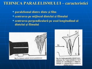 TEHNICA PARALELISMULUI – caracteristici
       paralelismul dintre dinte şi film
       centrarea pe mijlocul dintelui şi filmului
       centrarea perpendiculară pe axul longitudinal al
        dintelui şi filmului
 